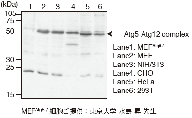 Anti-Atg5 mAb（Code No. M153-3, Clone:4D3） Western Blotting