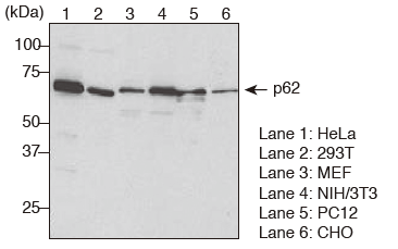 Anti-p62 (SQSTM1) pAbのWestern blotting