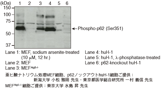 Anti-Phospho-p62 (SQSTM1) (Ser351) pAbCode No. PM074）Western blotting