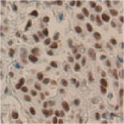Anti-Nucleolin mAb ヒト胃　免疫組織化学染色像