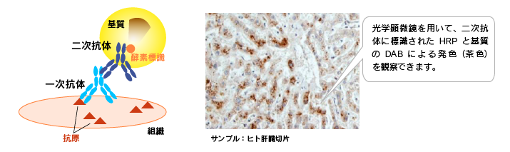 酵素標識の例：免疫組織染色