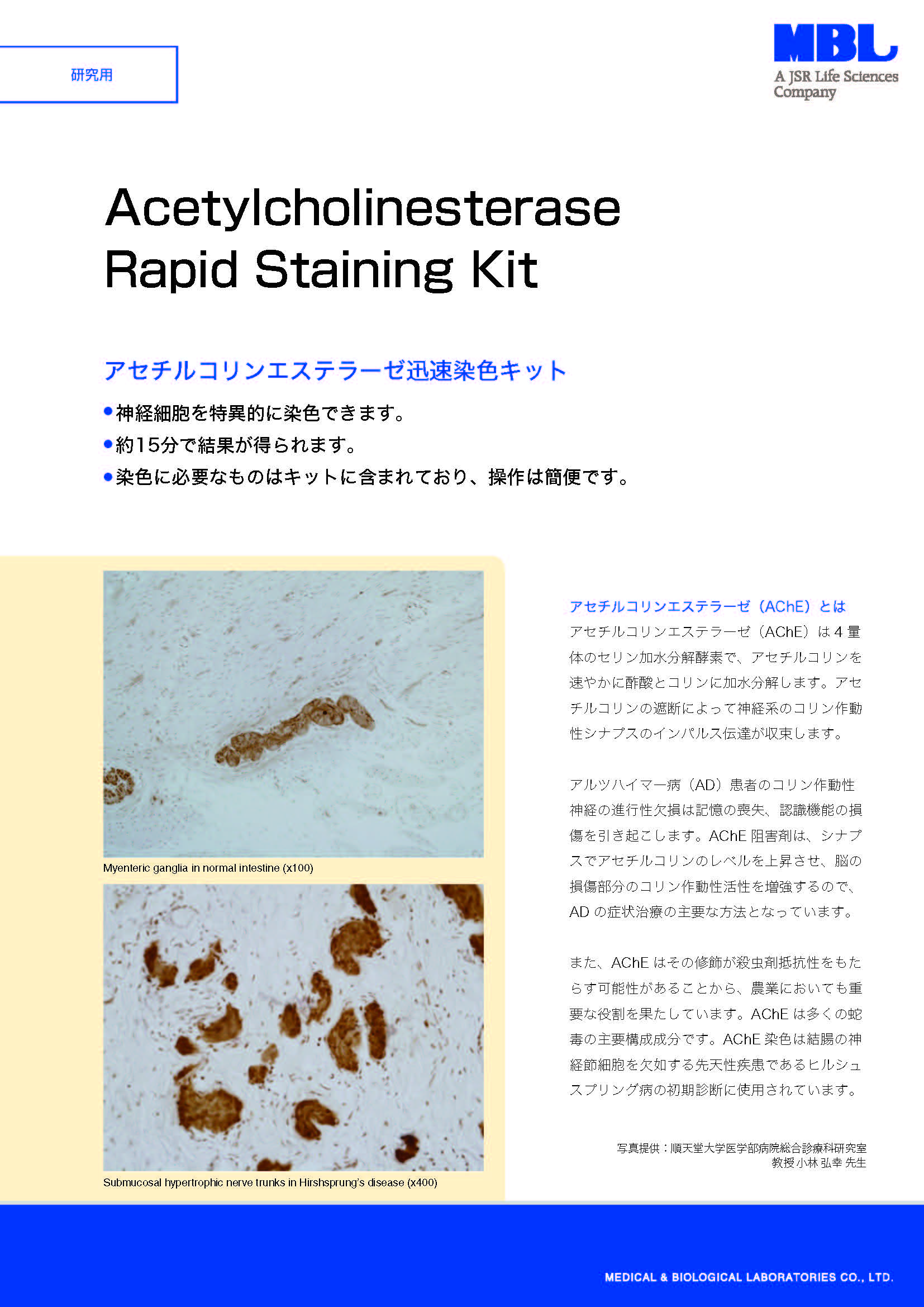 Acetylcholinesterase Rapid Staining Kit