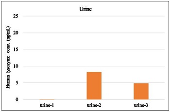 Human lysozyme concentration in urine samples