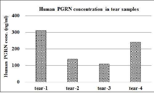 Human progranulin concentration of human tear samples