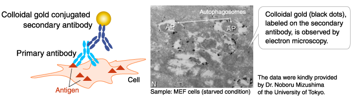 Colloidal gold: Immunoelectron micrograph
