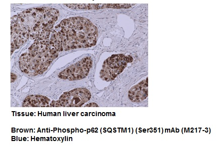 Anti-Phospho-p62 (SQSTM1) (Ser351) mAb（Code No. M217-3）Immunocytochemistry