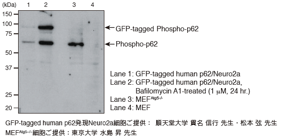 Phospho-p62 (Ser403)（Code No. D343-3, Clone:4F6）Western blotting
