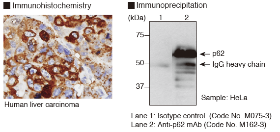 Anti-p62 (SQSTM1) (Human) mAbのImmunohistochemistory, Immunoprecipitation