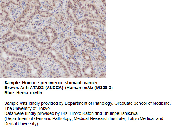ATAD2の免疫組織染色例