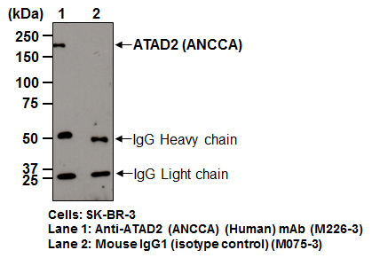 ATAD2の免疫沈降例