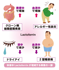 体液中Lactoferrinが増減する疾患の一部