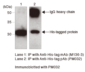 His-tagモノクローナル抗体（クローン:2D8) 免疫沈降