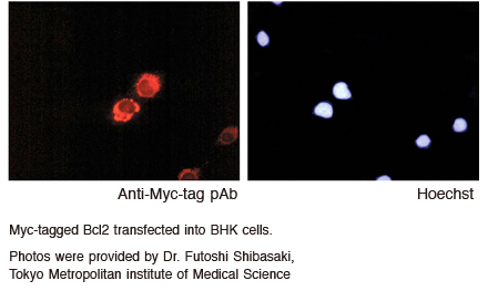 Myc-tagポリクローナル抗体 細胞染色