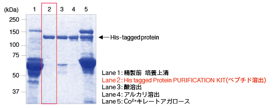 His tagged Protein PURIFICATION KITを用いた有血清培養上清からのタンパク質精製