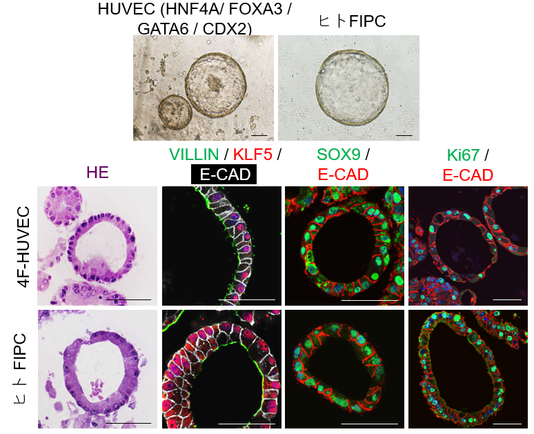 図6. ヒト臍帯静脈内皮細胞（HUVEC）にHNF4A、FOXA3、GATA6、CDX2を導入すると、ヒトFIPCと同様にSOを形成し、腸上皮細胞マーカーを発現する。（参考文献8より引用）