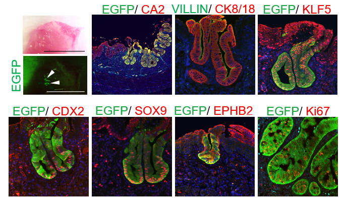 図7. EGFPでマークしたヒトiFPC由来のSOを大腸炎モデルマウスに移植すると、大腸上皮細胞マーカー（CA2）、ヒト細胞特異的CK8/18、腸上皮細胞マーカー（KLF5、CDX2）、腸幹/前駆細胞マーカー（SOX9、EPHB2）、増殖している細胞もマーカー（Ki67）を発現する。（参考文献8より引用）