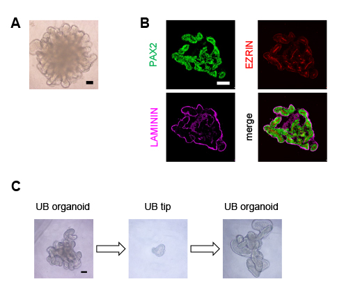 図1　ヒトiPS細胞から分枝形態形成を行う尿管芽オルガノイドの作製