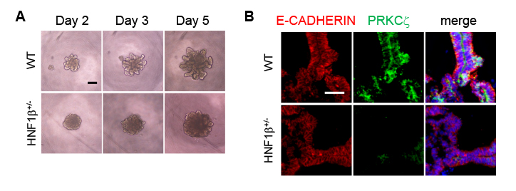 図4　ヒトiPS細胞由来尿管芽オルガノイド技術を用いた疾患モデルの作製